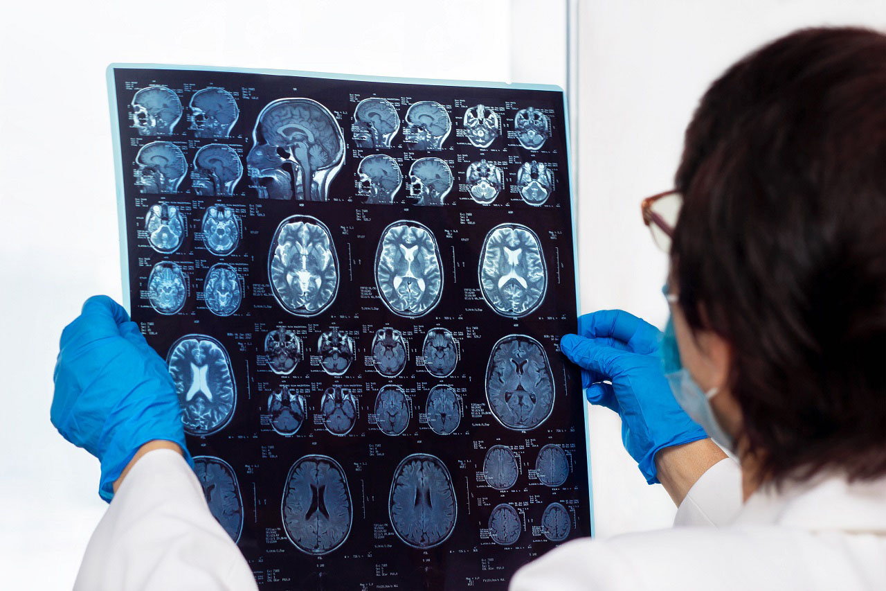 Что такое магнитно-резонансная томография головного мозга Что такое магнитно-резонансная томография головного мозга