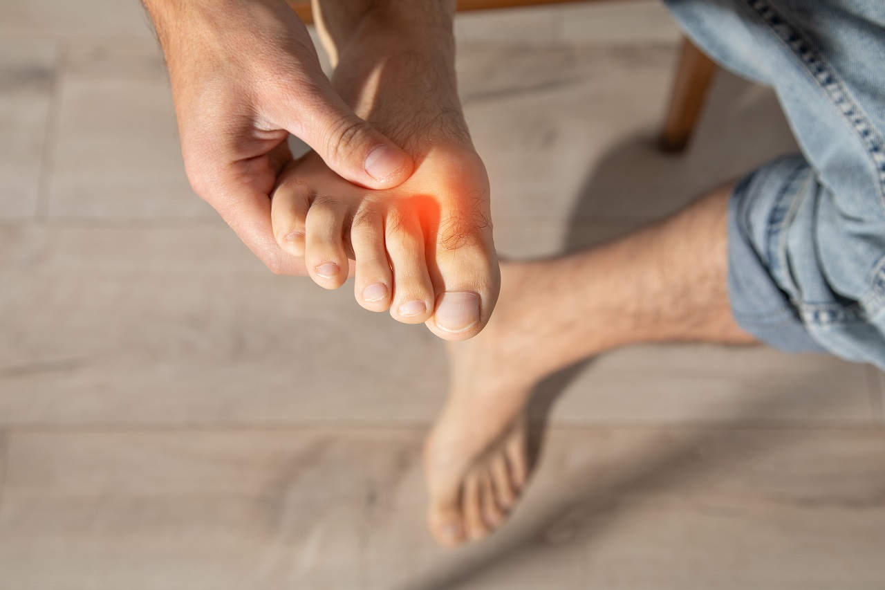 Ушиб пальца: как отличить его от перелома и оказать первую помощь - 7