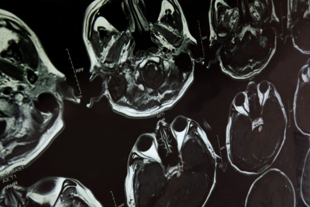 КТ головы в Уфе - цены на услуги, сделать компьютерную томографию ...